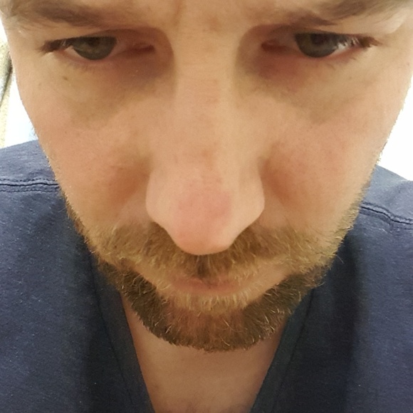 schimmerloo